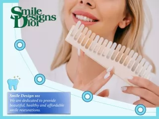 Why to choose Dental Implants?