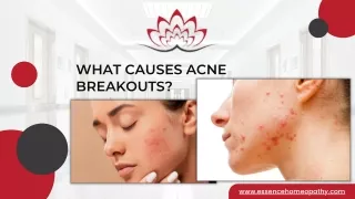 What Causes Acne Breakouts | Essence Homeopathic Clinics