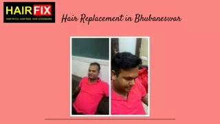 Hair Replacement in Bhubaneswar