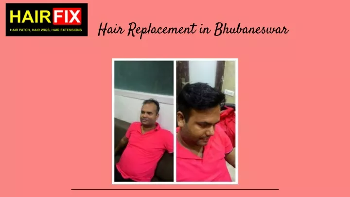 hair replacement in bhubaneswar