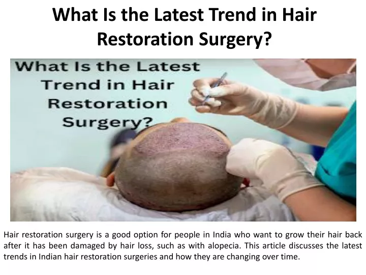 what is the latest trend in hair restoration