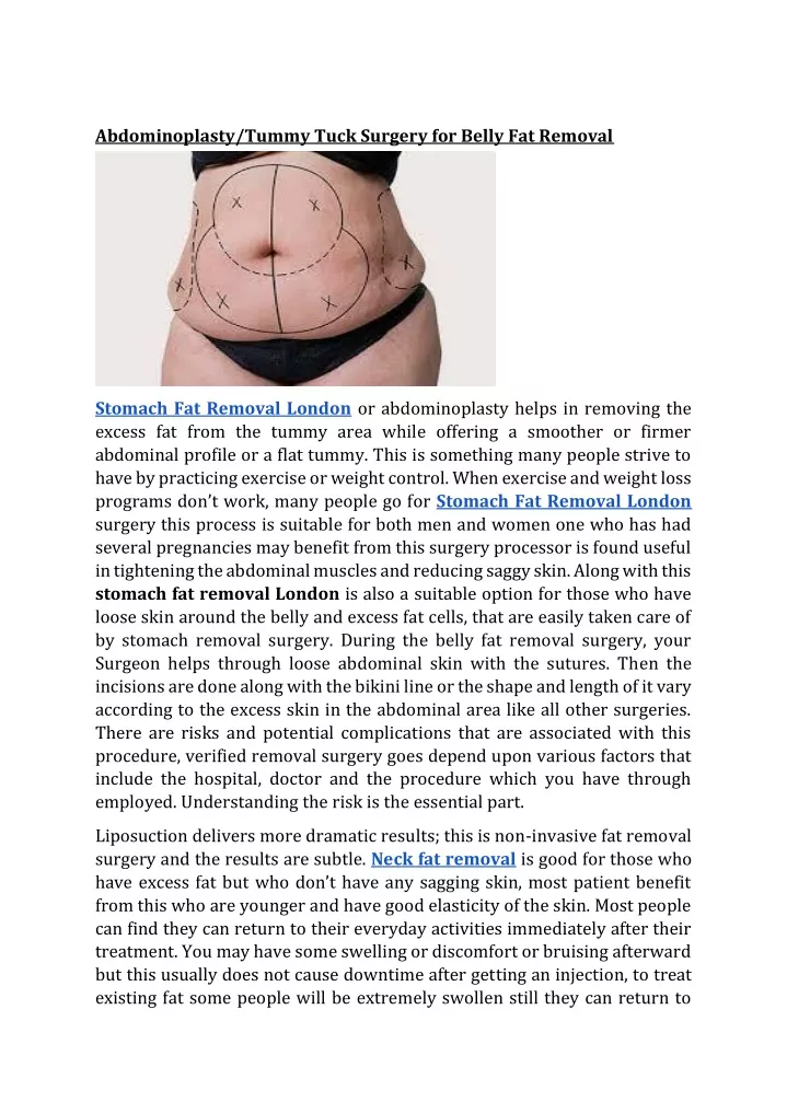 abdominoplasty tummy tuck surgery for belly