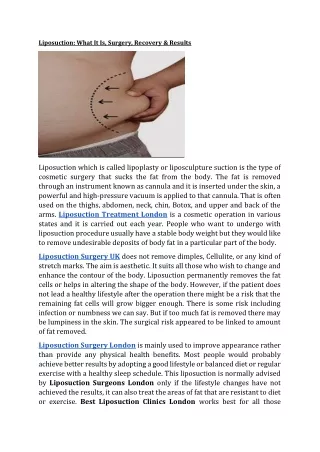 Liposuction: What It Is, Surgery, Recovery & Results