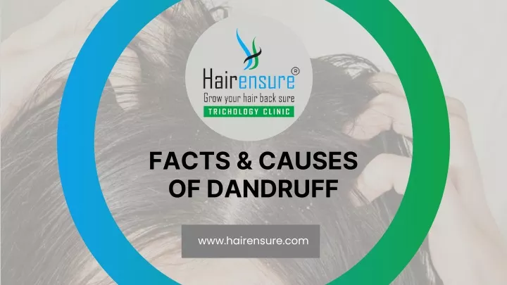 facts causes of dandruff