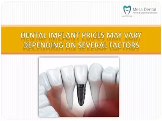 Dental Implant Prices May Vary Depending On Several Factors