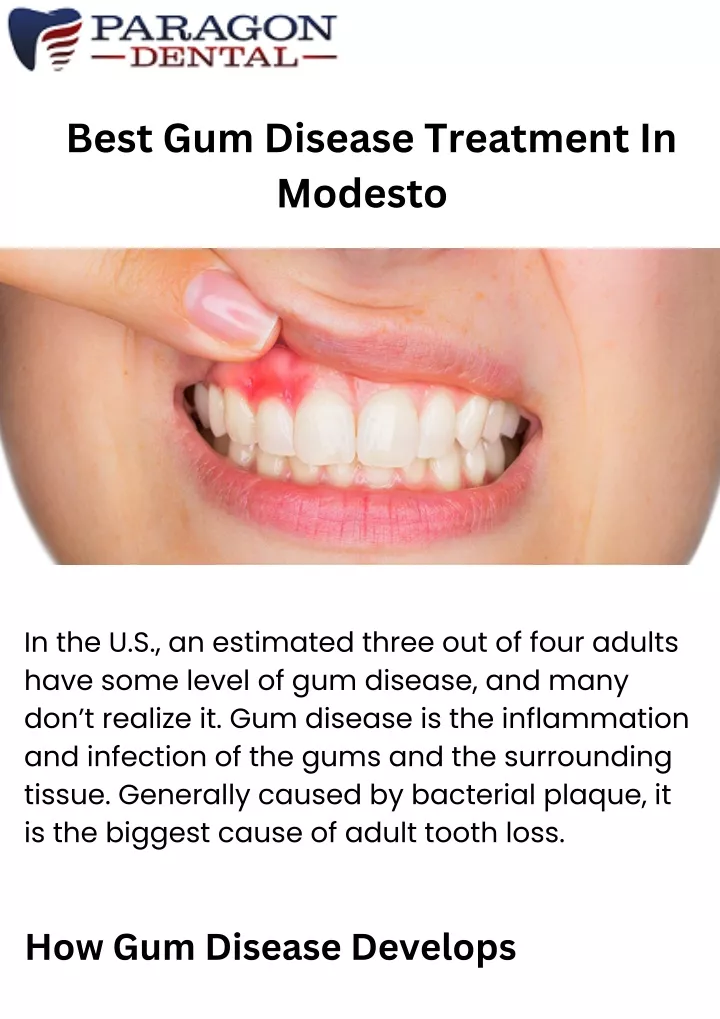 best gum disease treatment in modesto