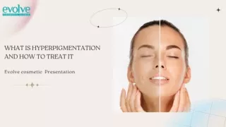 What is Hyperpigmentation and How to Treat It
