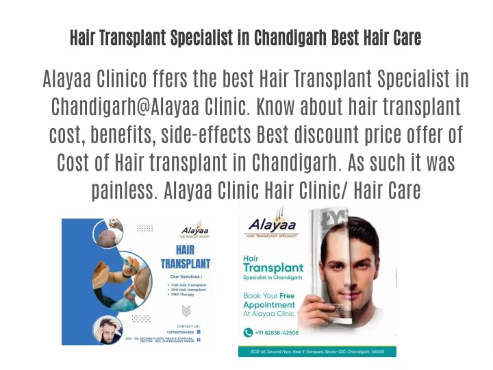 hair transplant specialist in chandigarh best