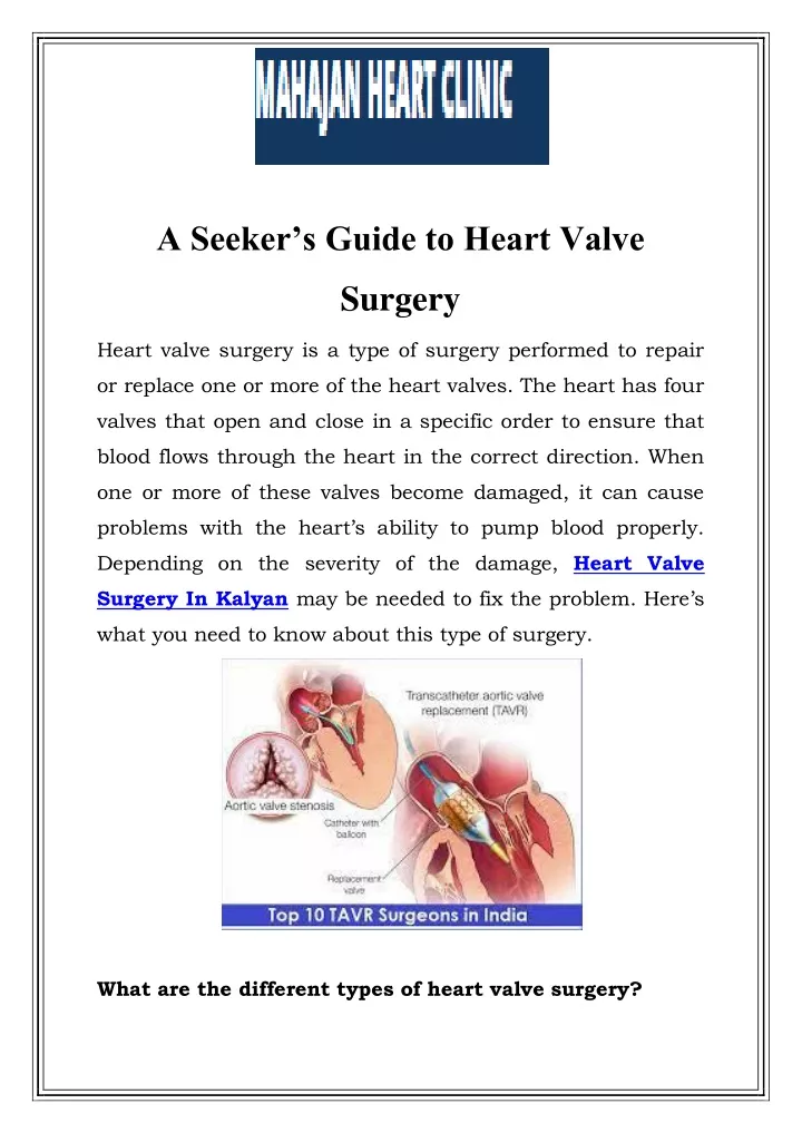 a seeker s guide to heart valve