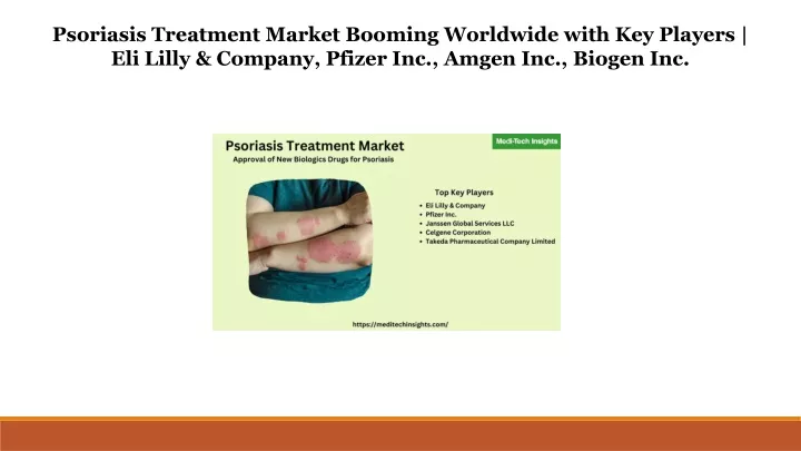 psoriasis treatment market booming worldwide with