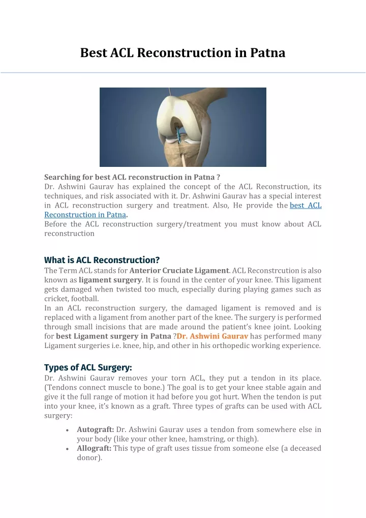 best acl reconstruction in patna