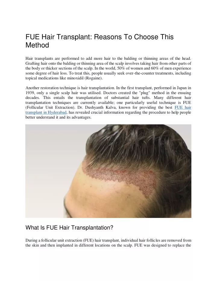 fue hair transplant reasons to choose this method