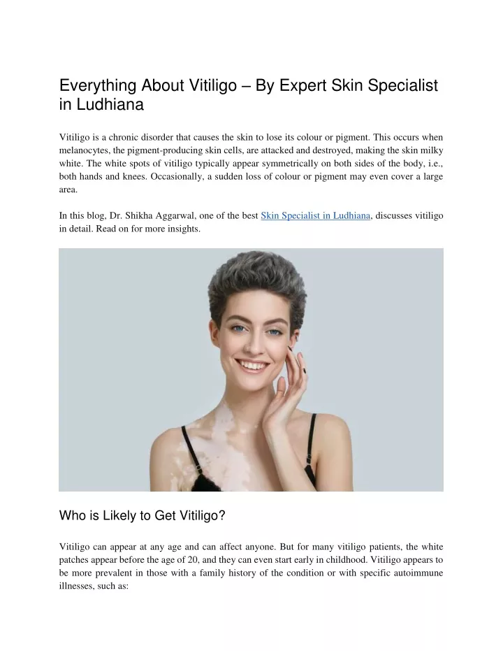 everything about vitiligo by expert skin