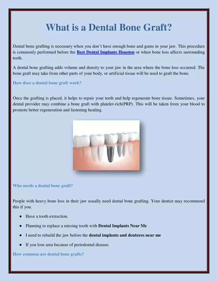 what is a dental bone graft