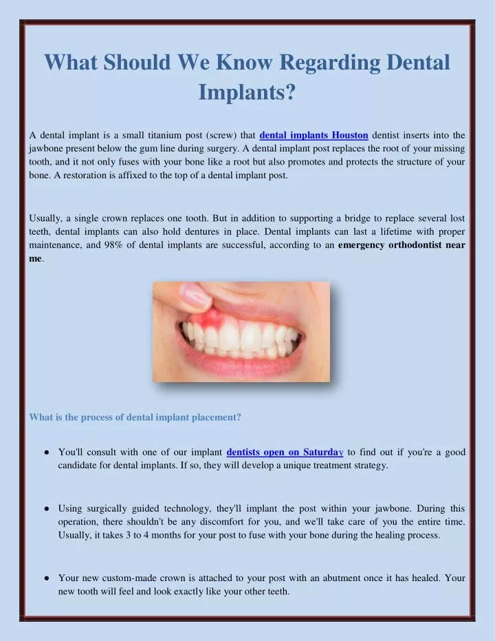 what should we know regarding dental implants