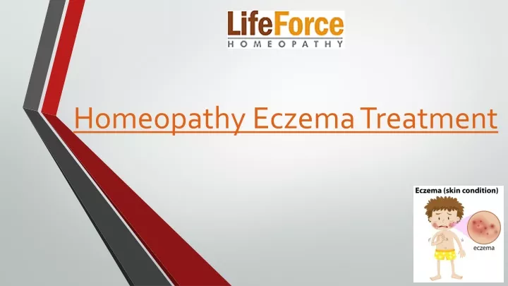 homeopathy eczema treatment