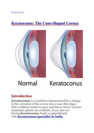 Keratoconus Surgery In Mumbai By Dr. Niteen Dedhia