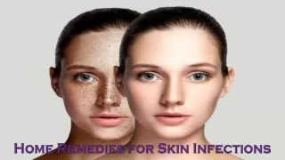 Home Remedies for Skin Infections