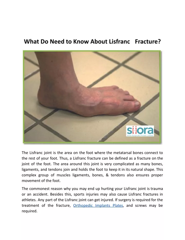 what do need to know about lisfranc fracture