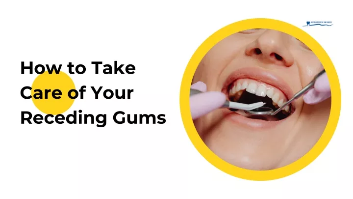 how to take care of your receding gums