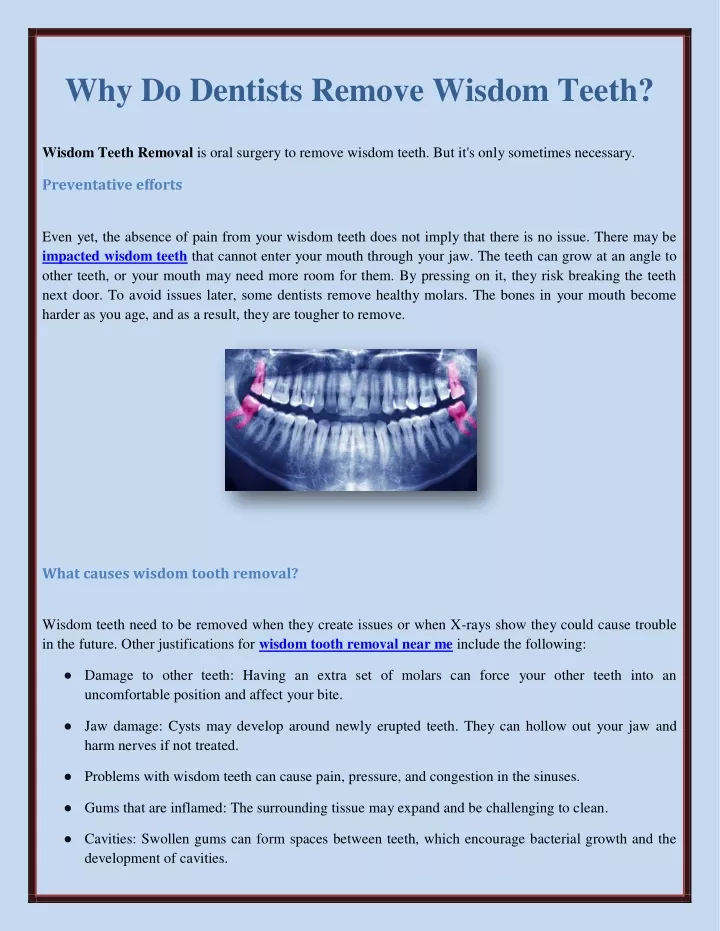 why do dentists remove wisdom teeth