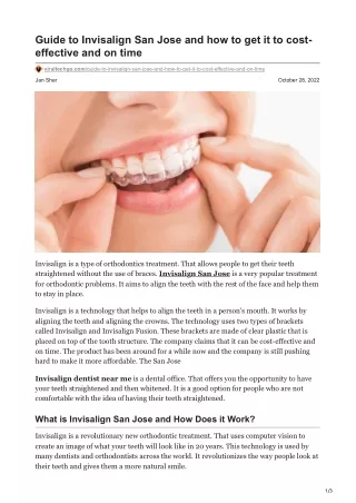 viraltechgo.com-Guide to Invisalign San Jose and how to get it to cost-effective and on time