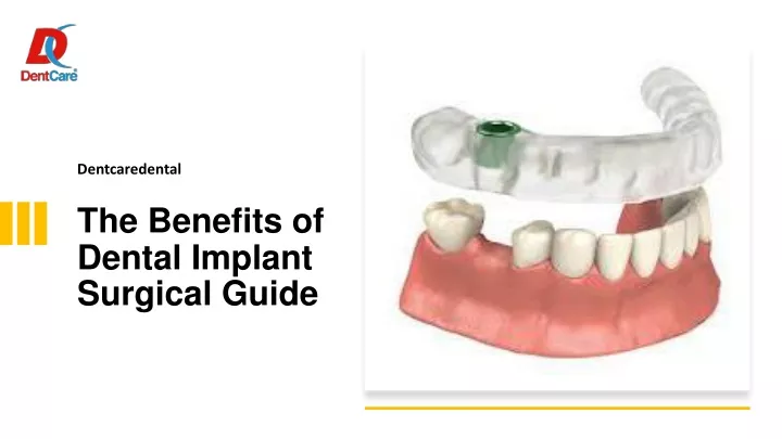 dentcaredental