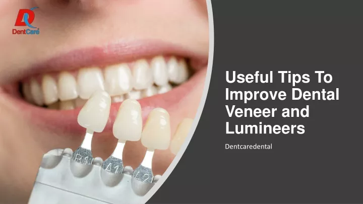 useful tips to improve dental veneer and lumineers