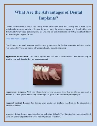 what are the advantages of dental implants