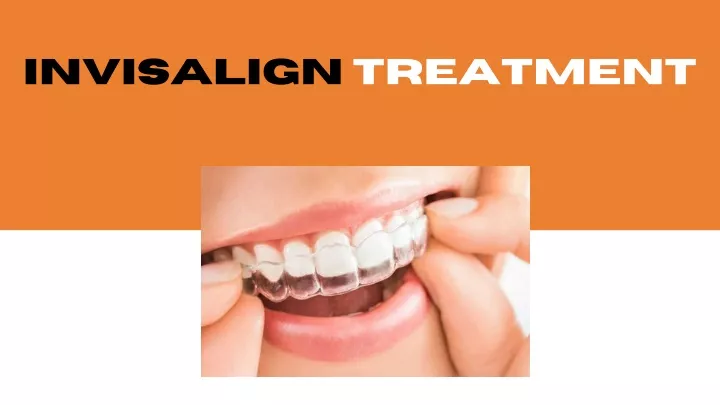 invisalign treatment