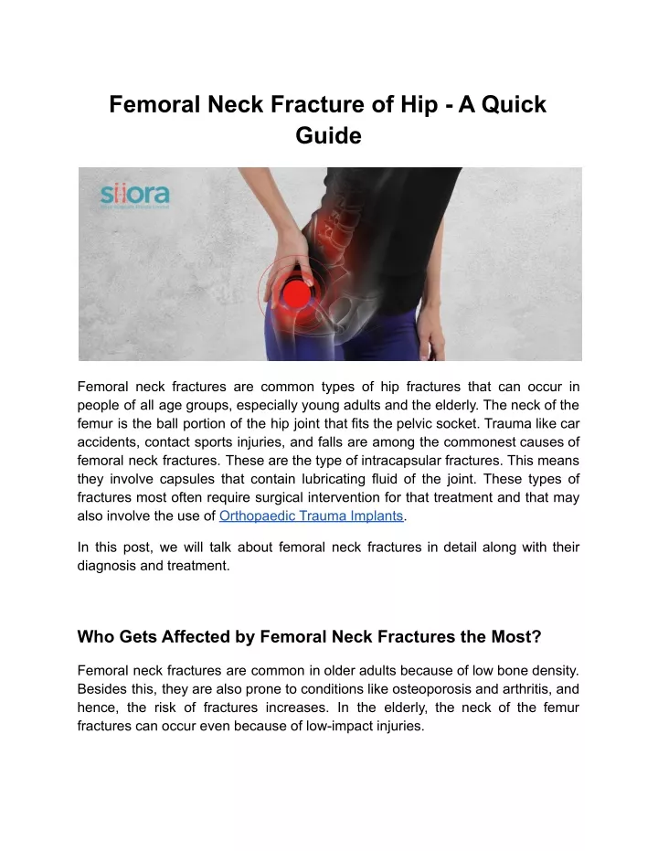 femoral neck fracture of hip a quick guide