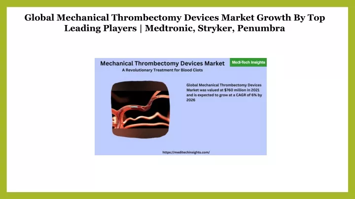 global mechanical thrombectomy devices market