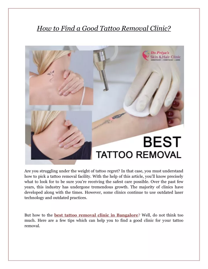 how to find a good tattoo removal clinic