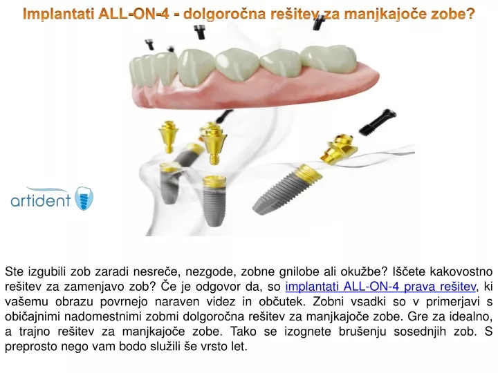 implantati all on 4 dolgoro na re itev