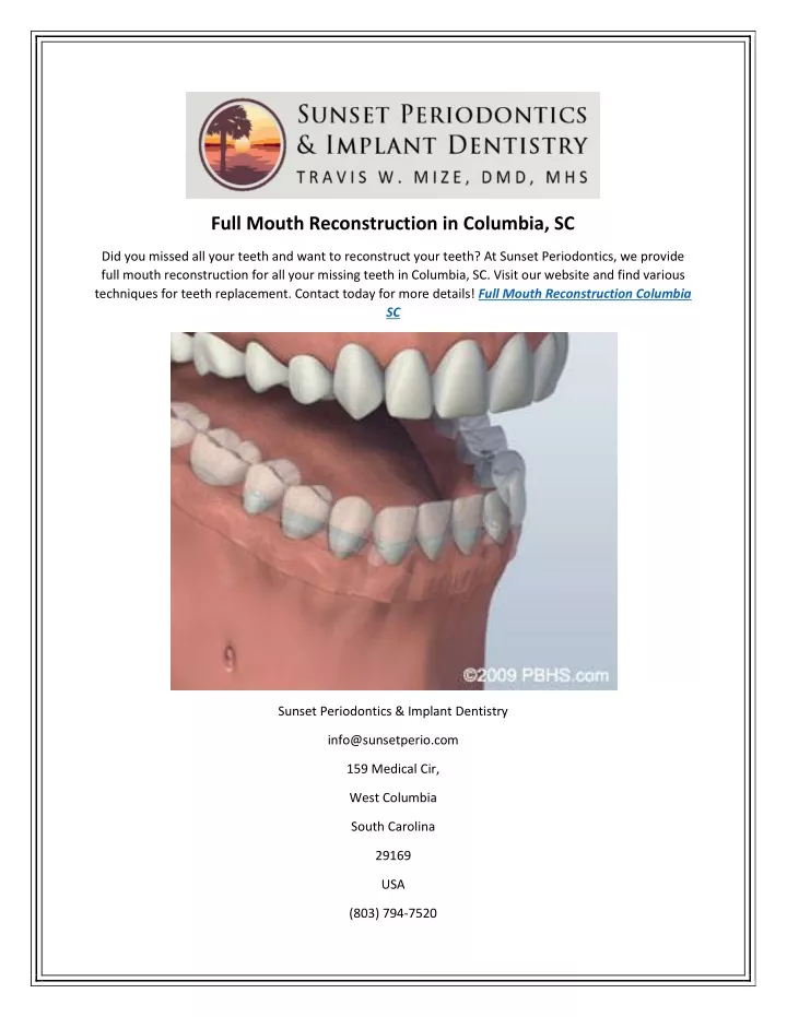 full mouth reconstruction in columbia sc