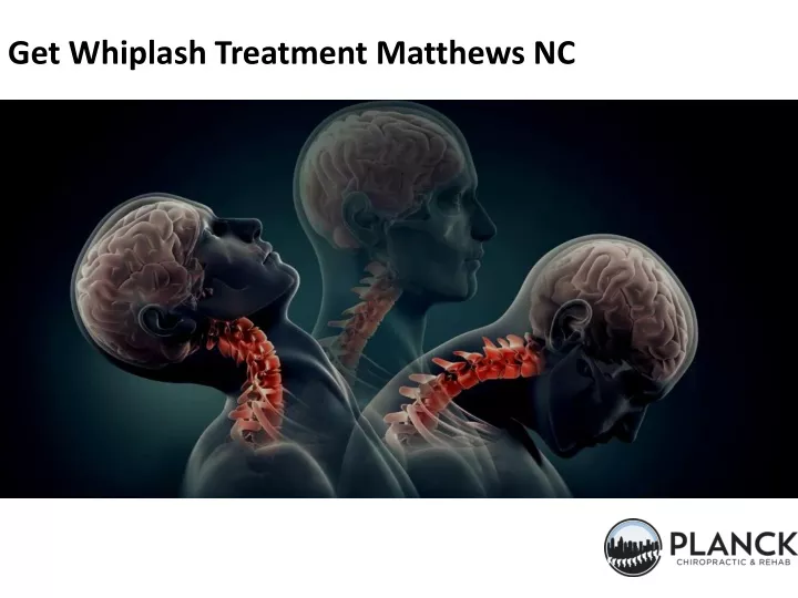 get whiplash treatment matthews nc