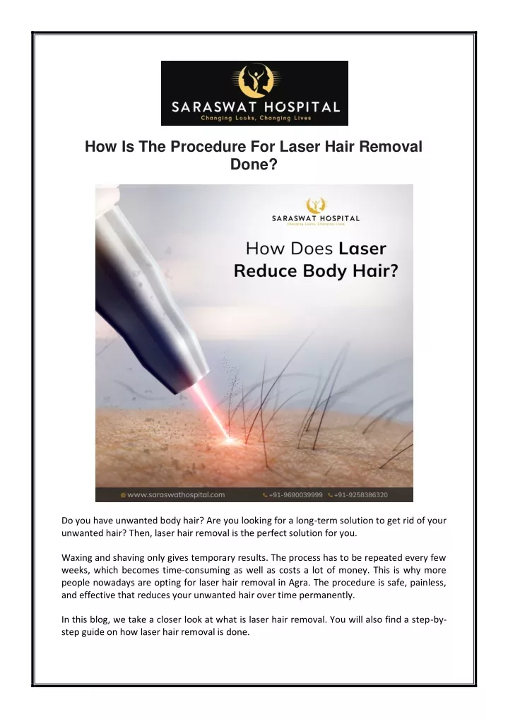 how is the procedure for laser hair removal done