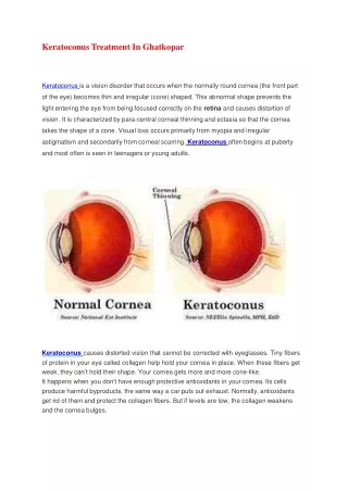 Keratoconus Treatment In Ghatkopa