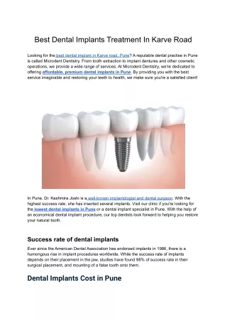 Best Dental Implants Treatment In Karve Road