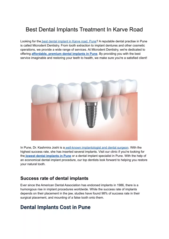 best dental implants treatment in karve road