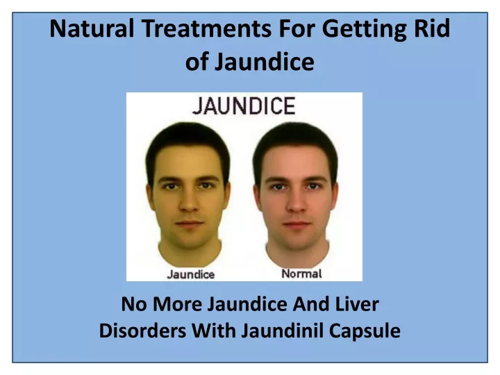 natural treatments for getting rid of jaundice