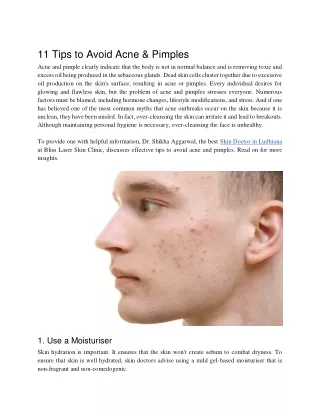 11 Tips to Avoid Acne & Pimples