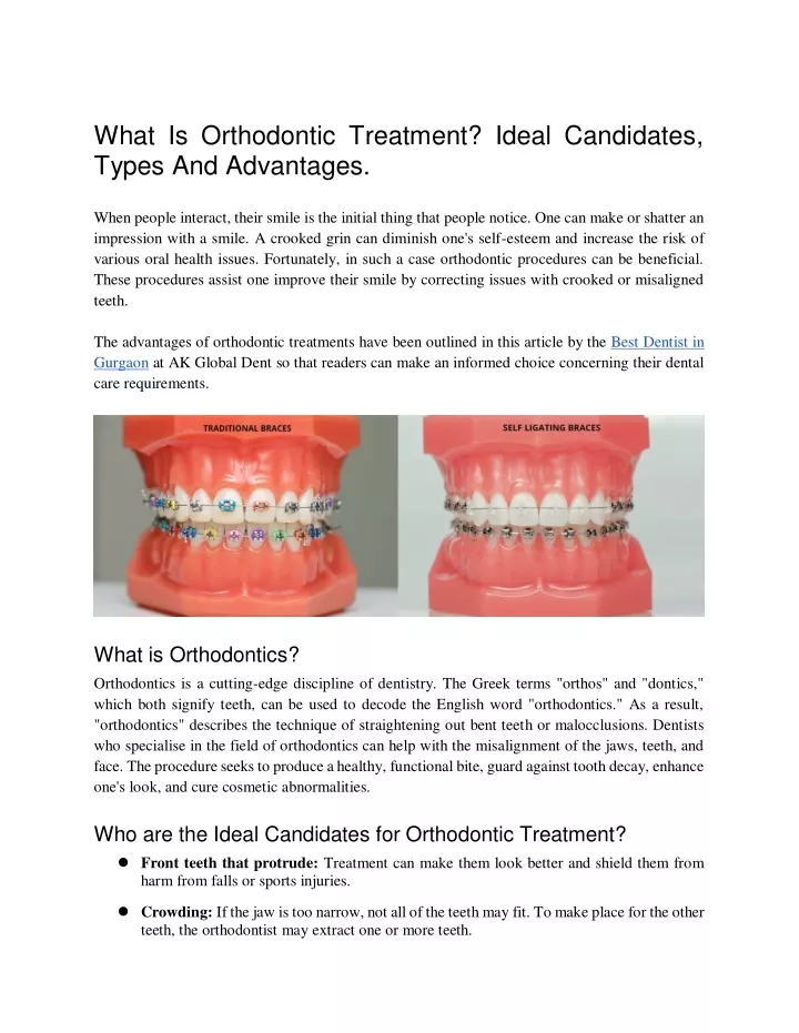 what is orthodontic treatment ideal candidates