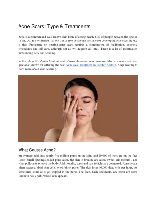 Acne Scars_ Type & Treatments