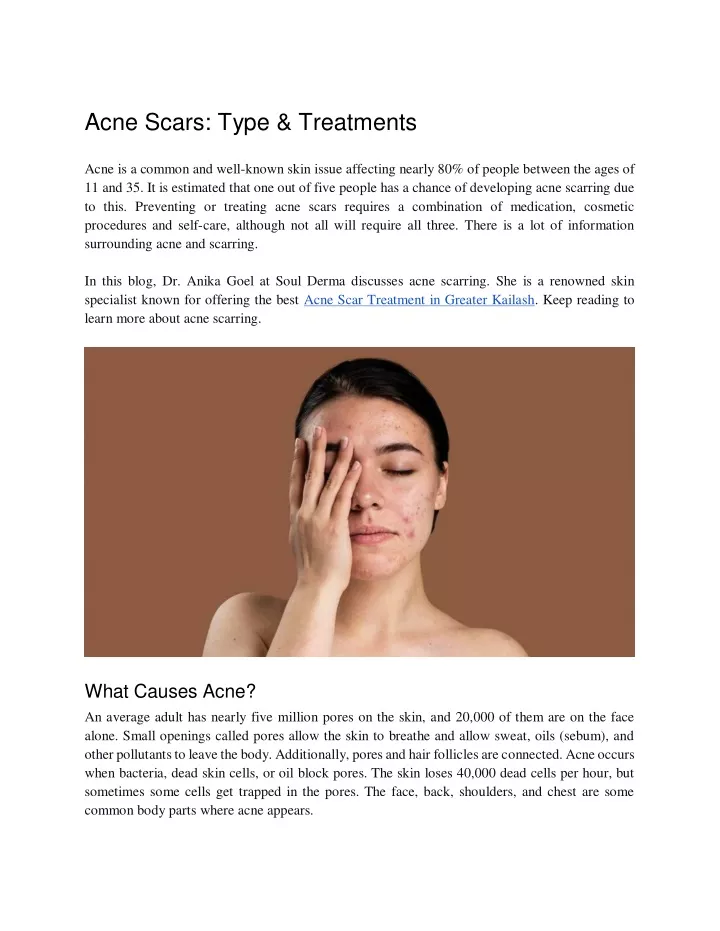 acne scars type treatments acne is a common