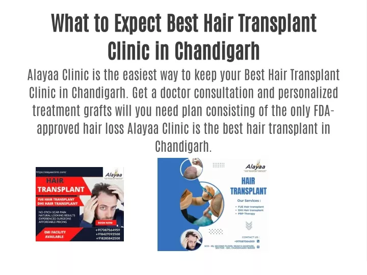 what to expect best hair transplant clinic