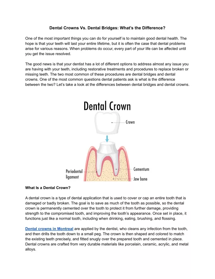 dental crowns vs dental bridges what