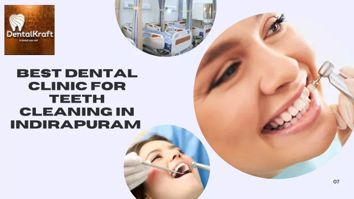 best dental clinic for teeth cleaning