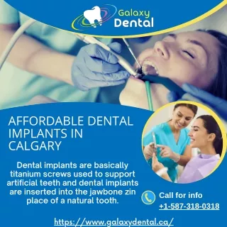 Calgary Dental Implants  Best Affordable Dental Implants Calgary