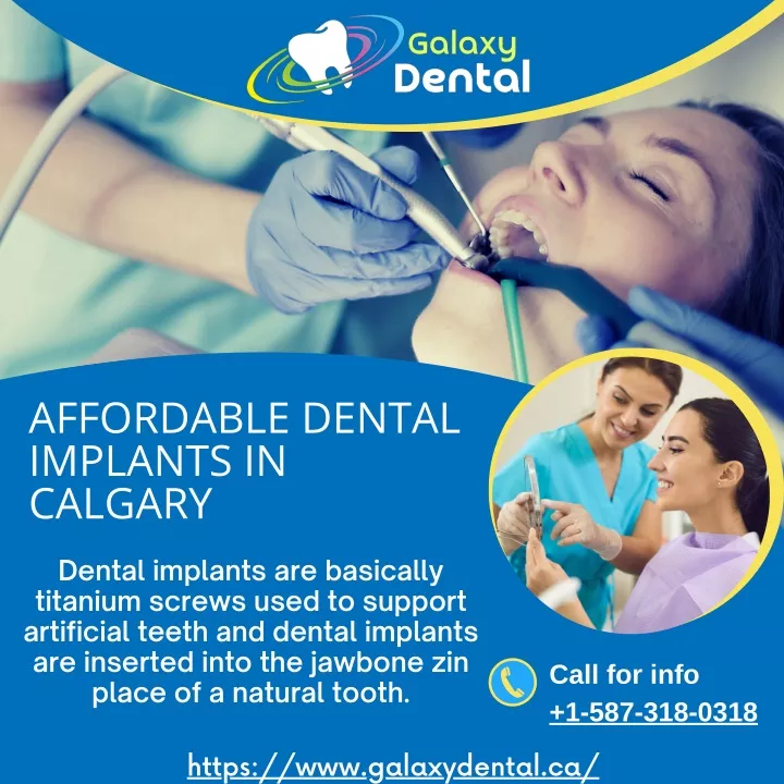 affordable dental implants in calgary